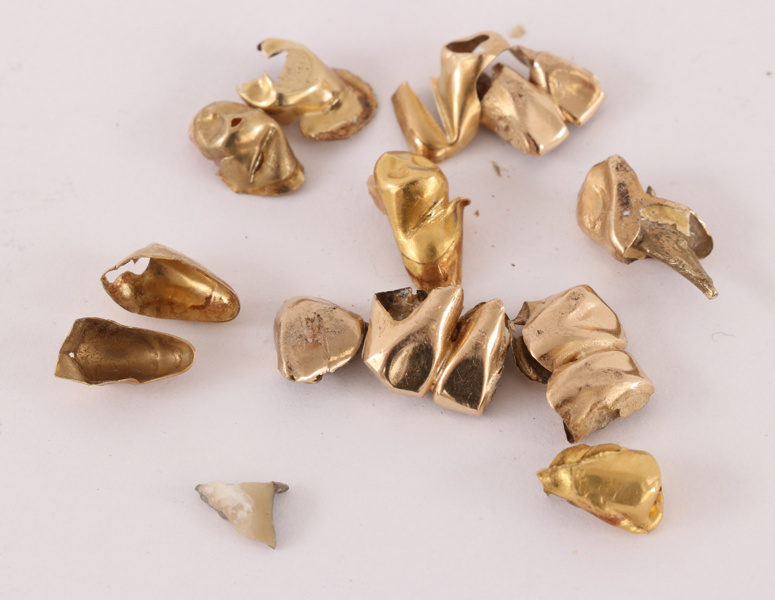 Parti tandguld, mestadels 18k