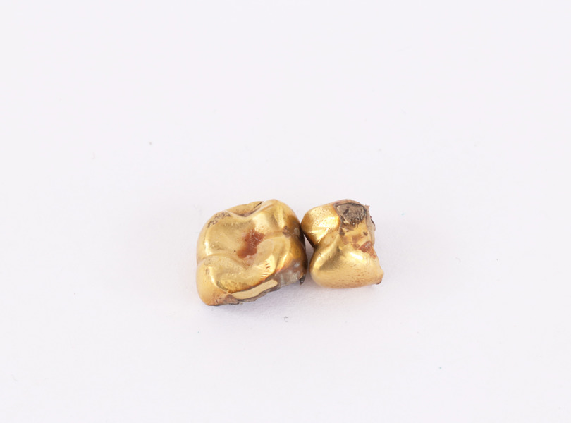 Tandguld 2 delar